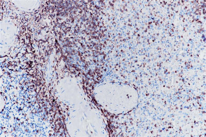 脾脏 CD3 (BP6039) 染色