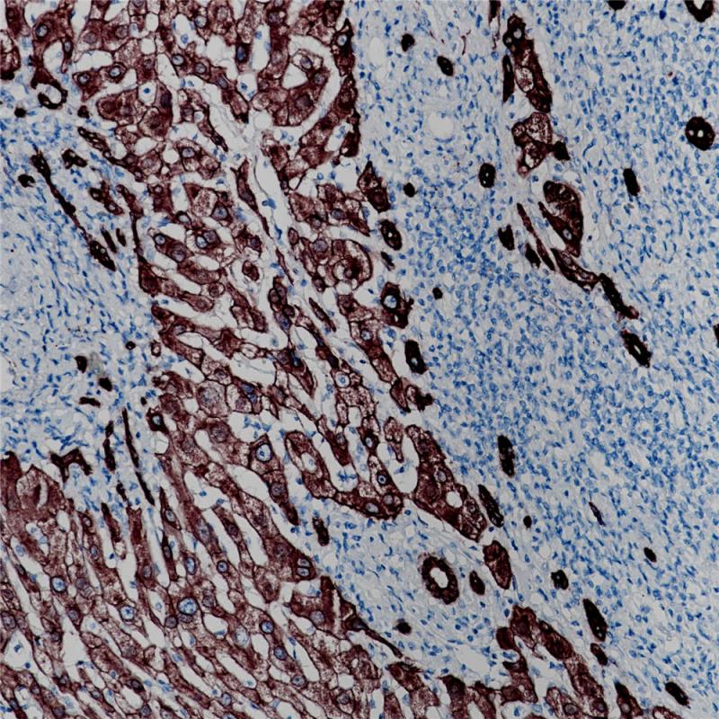 肝 CK18 (BP6054) 染色