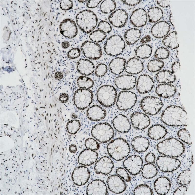 结肠 FOXP1 (BP6112) 染色