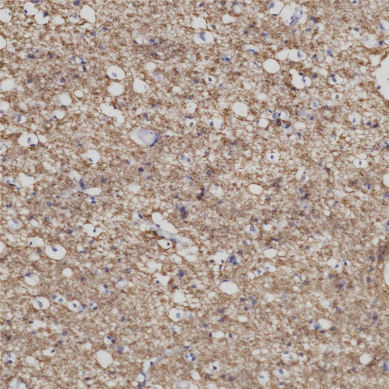 脑 MBP (BP6087) 染色