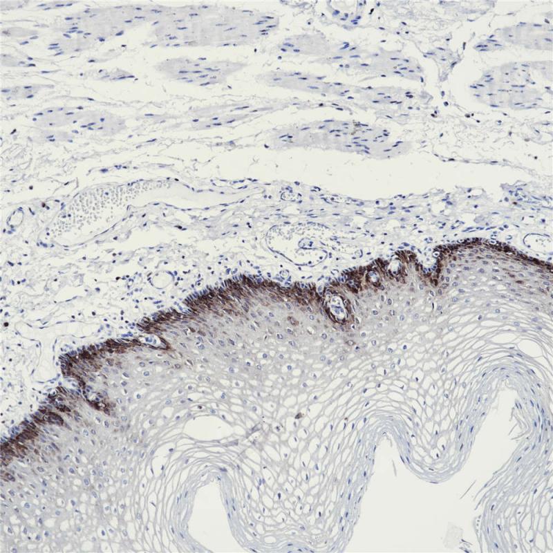 食管 RRM1 (BP6122) 染色