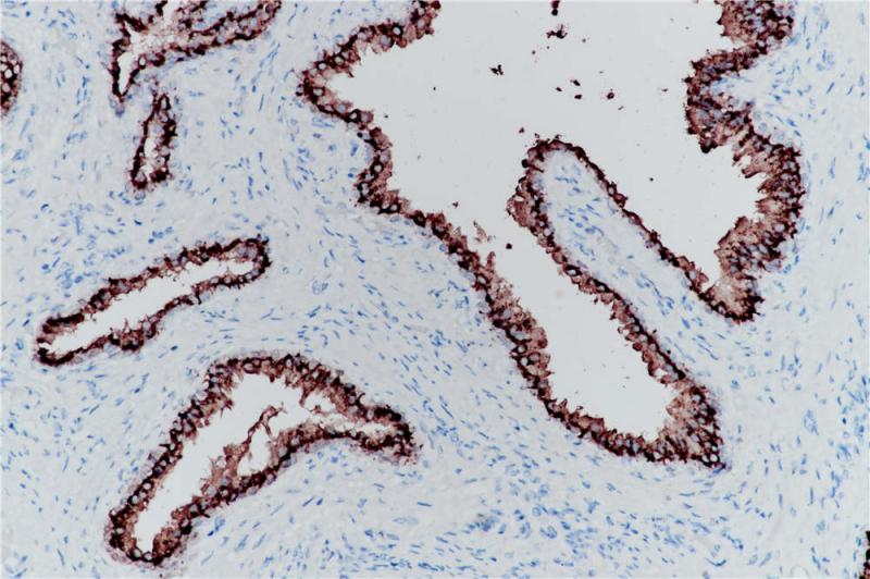 前列腺 PSAP (BP6050) 染色