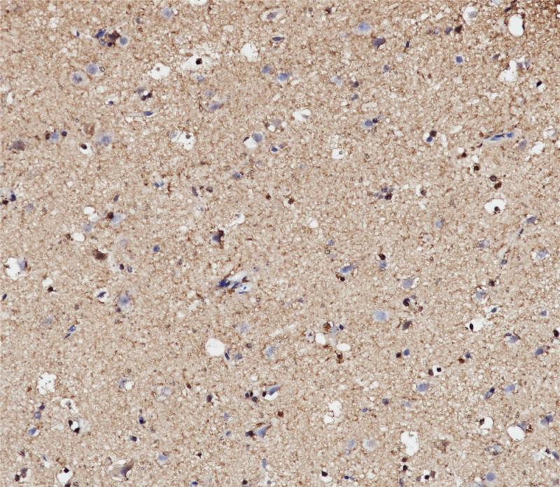 脑 S100 (BP6088) 染色