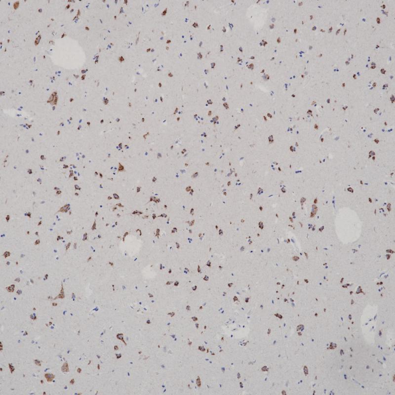 脑 Chromogranin A (BP6129) 染色