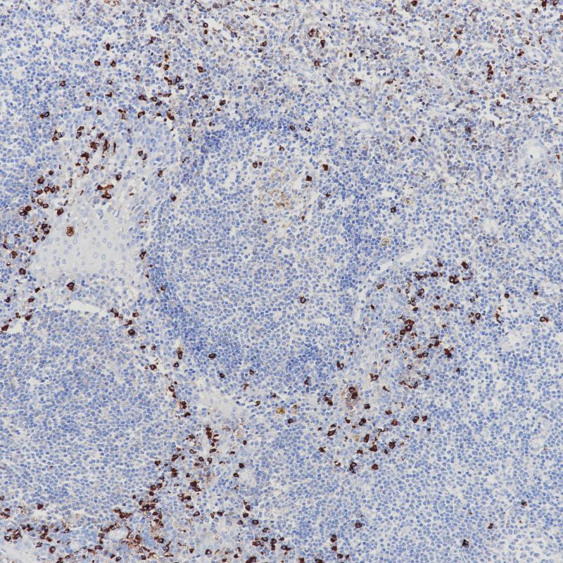 扁桃体 Lambda（BP6133）染色