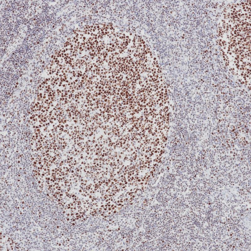 扁桃体 MSH2（BPM6143）染色