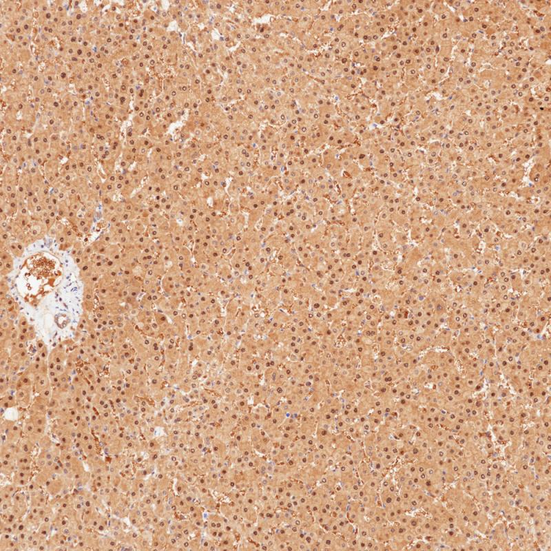 肝 Arginase-1 (BP6158) 染色