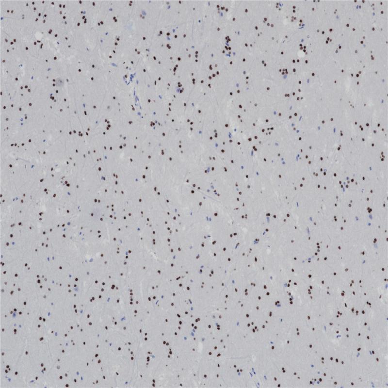 脑 Olig2 (BP6167) 染色.jpg