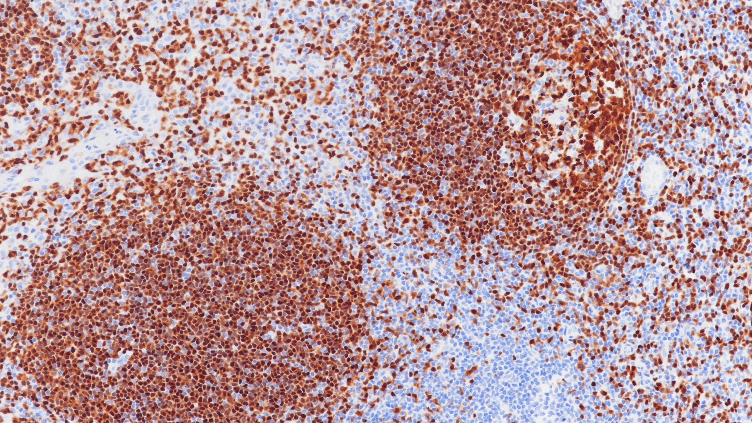 扁桃体Pax-5(BPM6172)染色