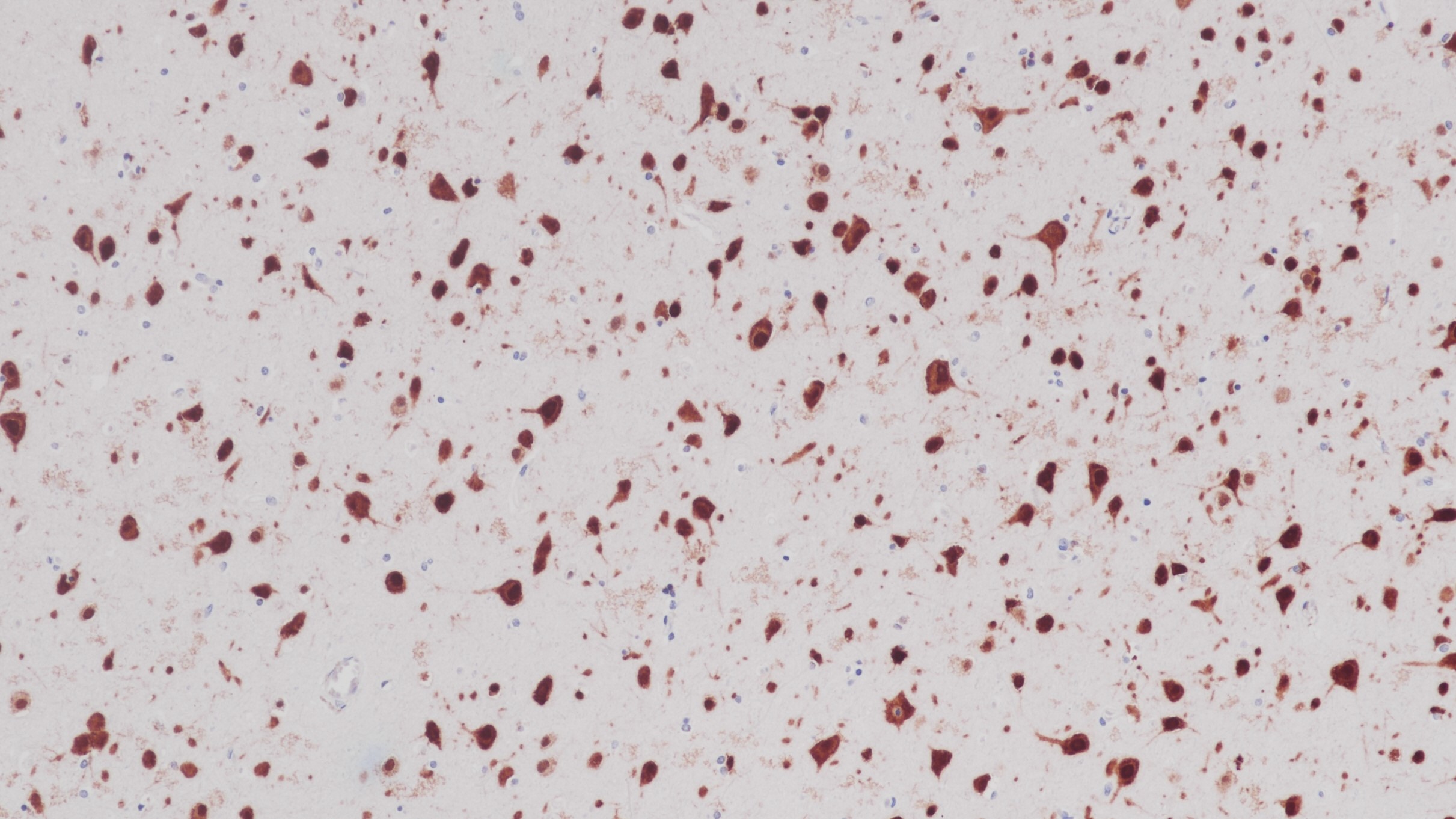 脑NeuN(BP6163)染色