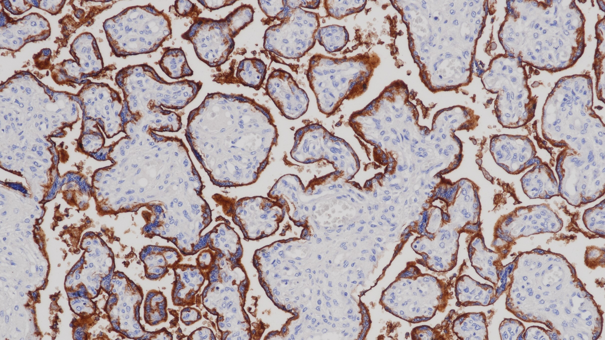 胎盘PLAP(BPM6151)染色 