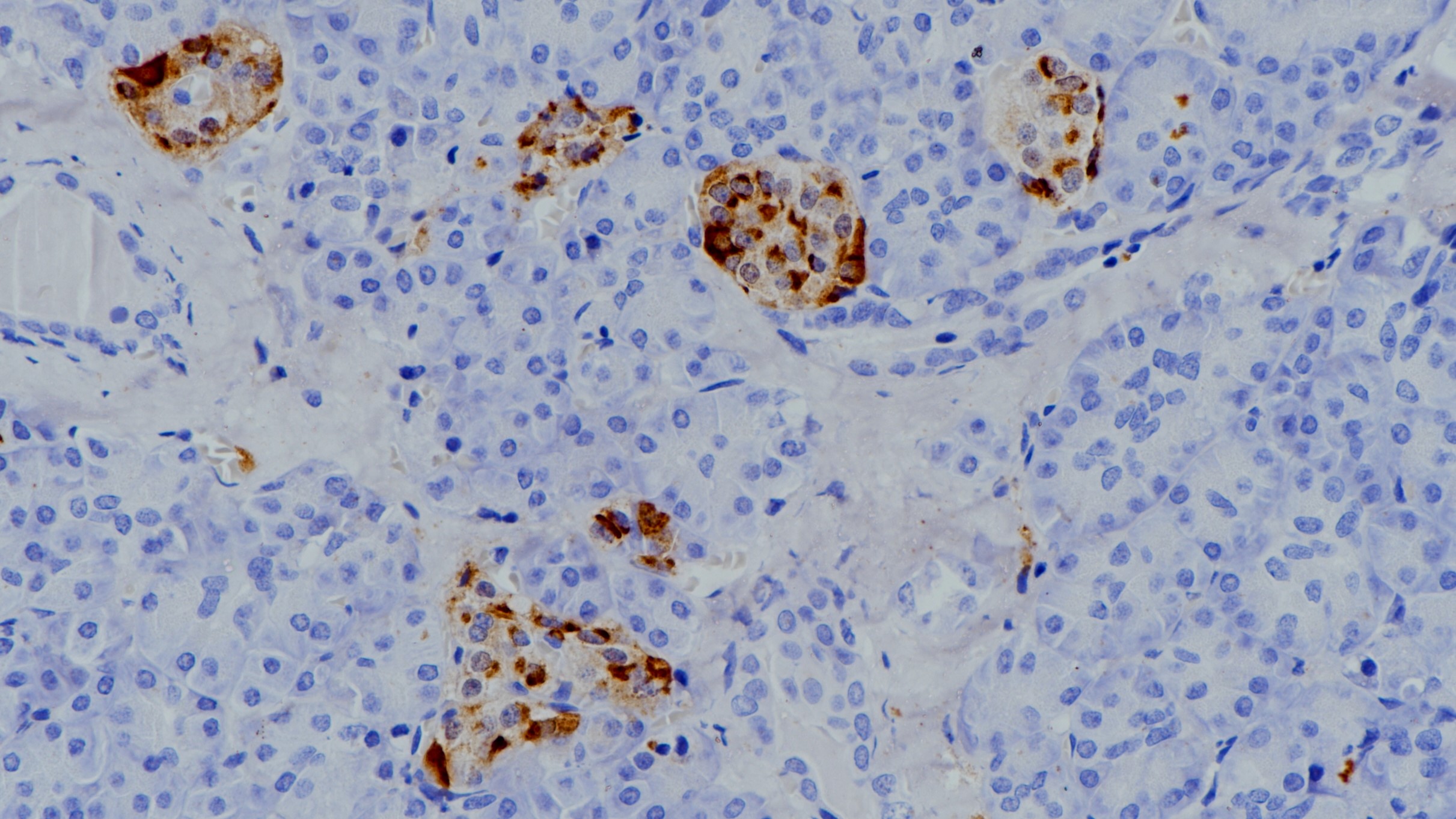 胰腺CgA(BP6129)染色