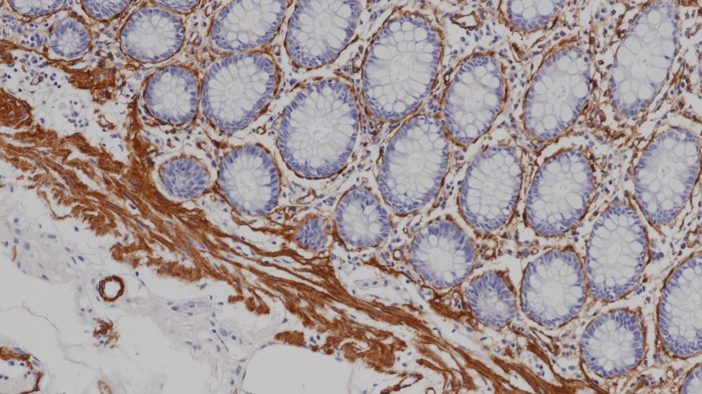 结肠SMA(1A4)染色