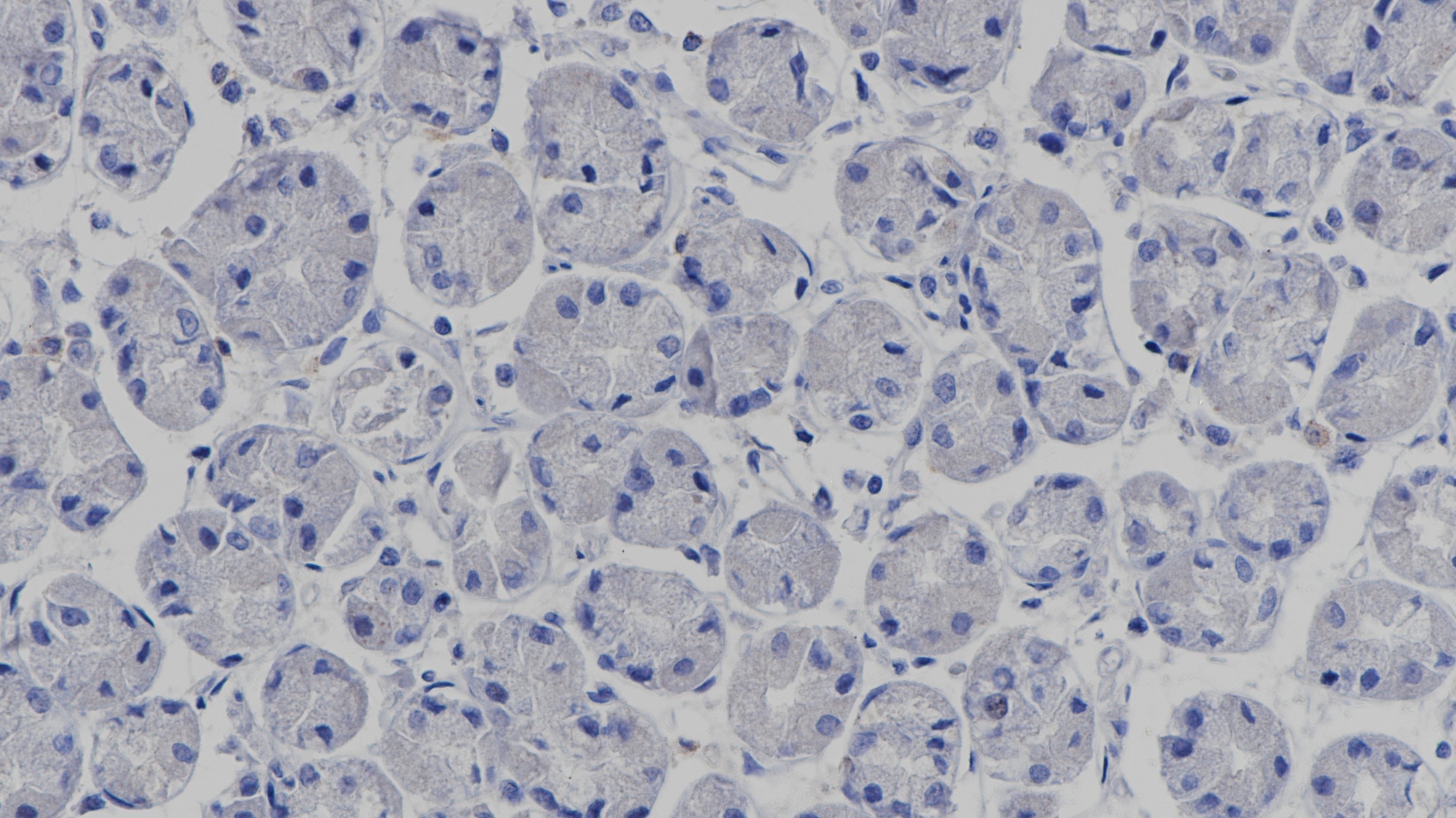 未感染HP的胃组织HP(EPR10353)染色