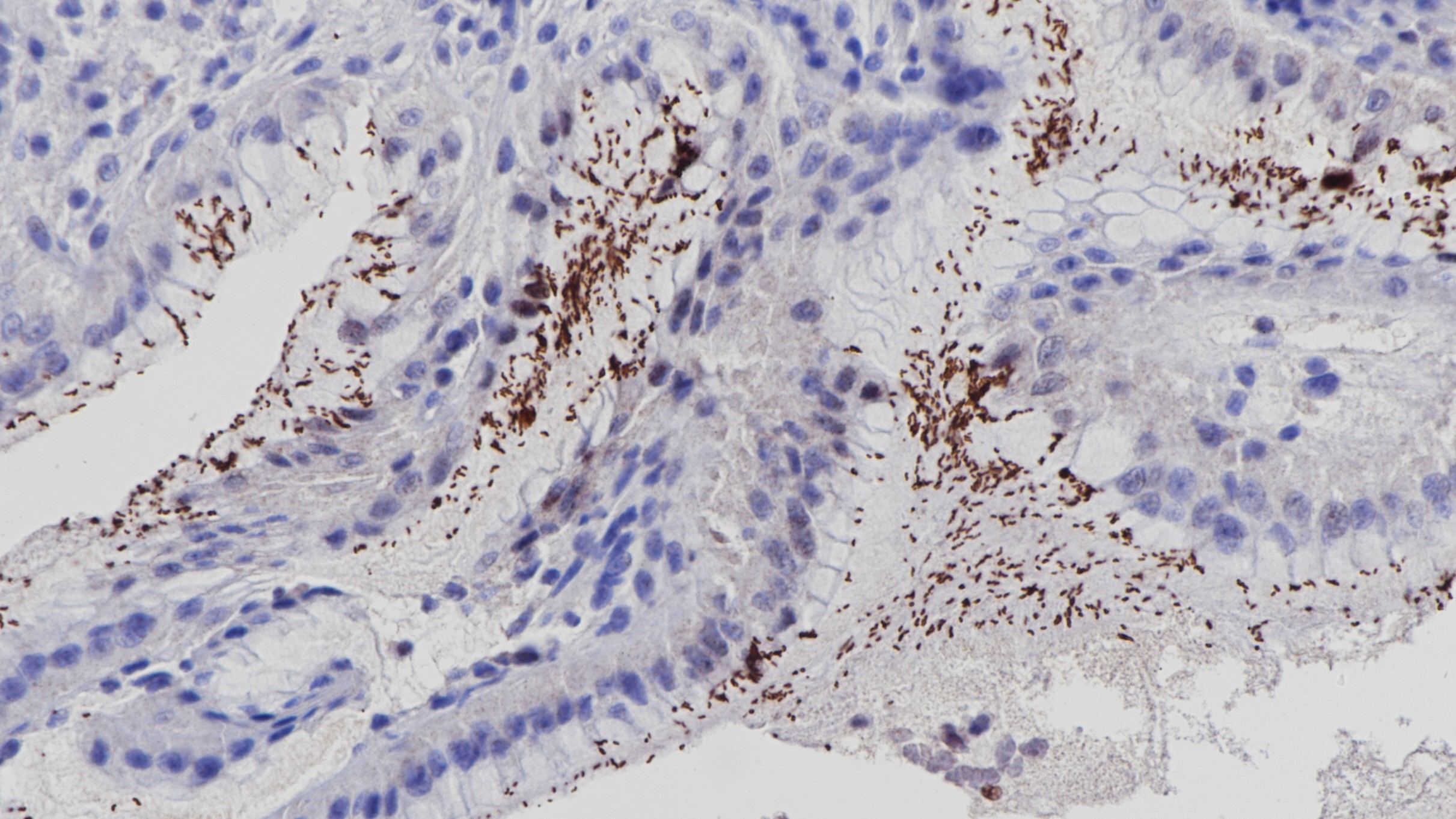 感染HP胃炎组织HP(EPR10353)染色