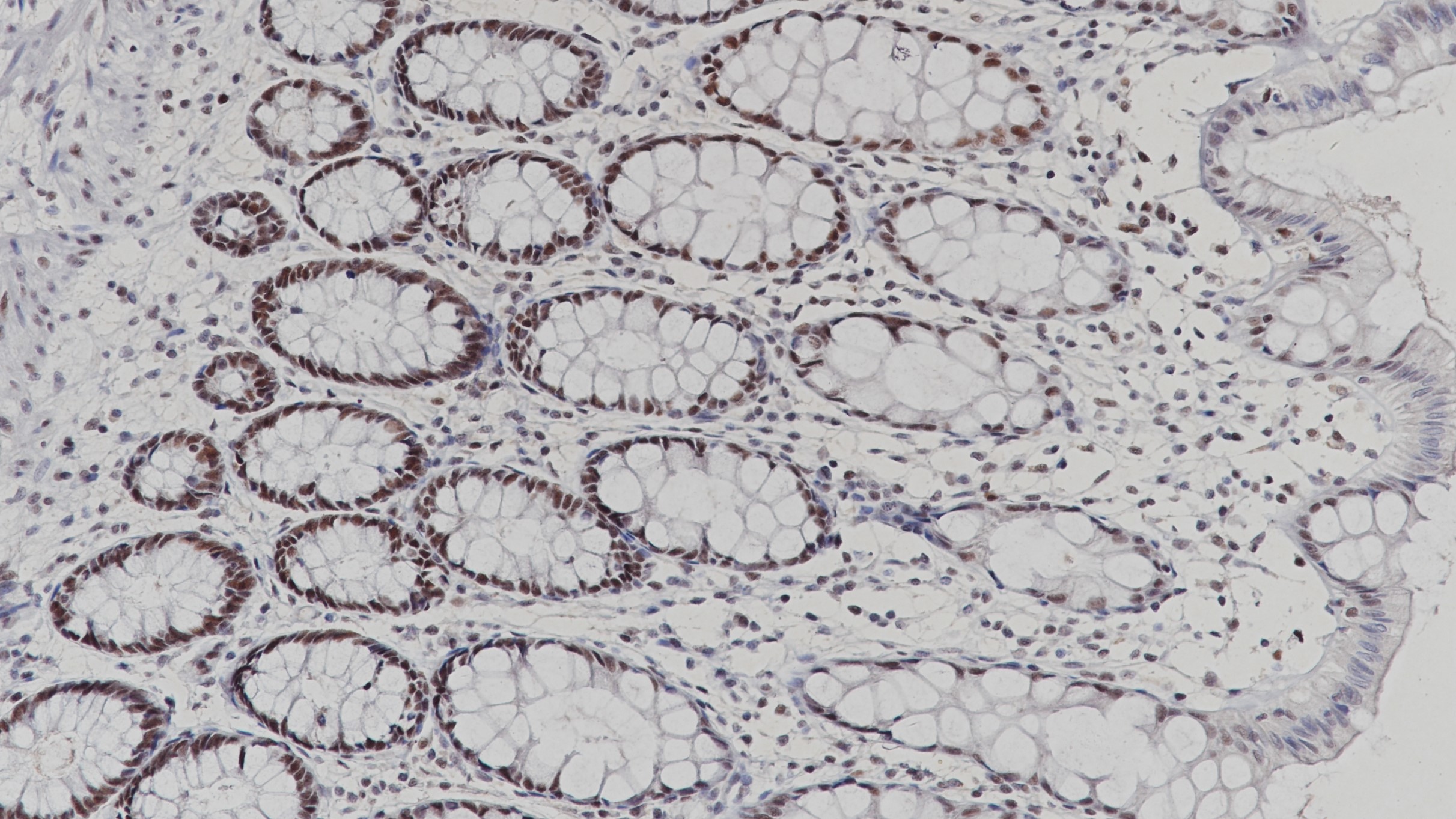 结肠PSM2(BP6116)染色