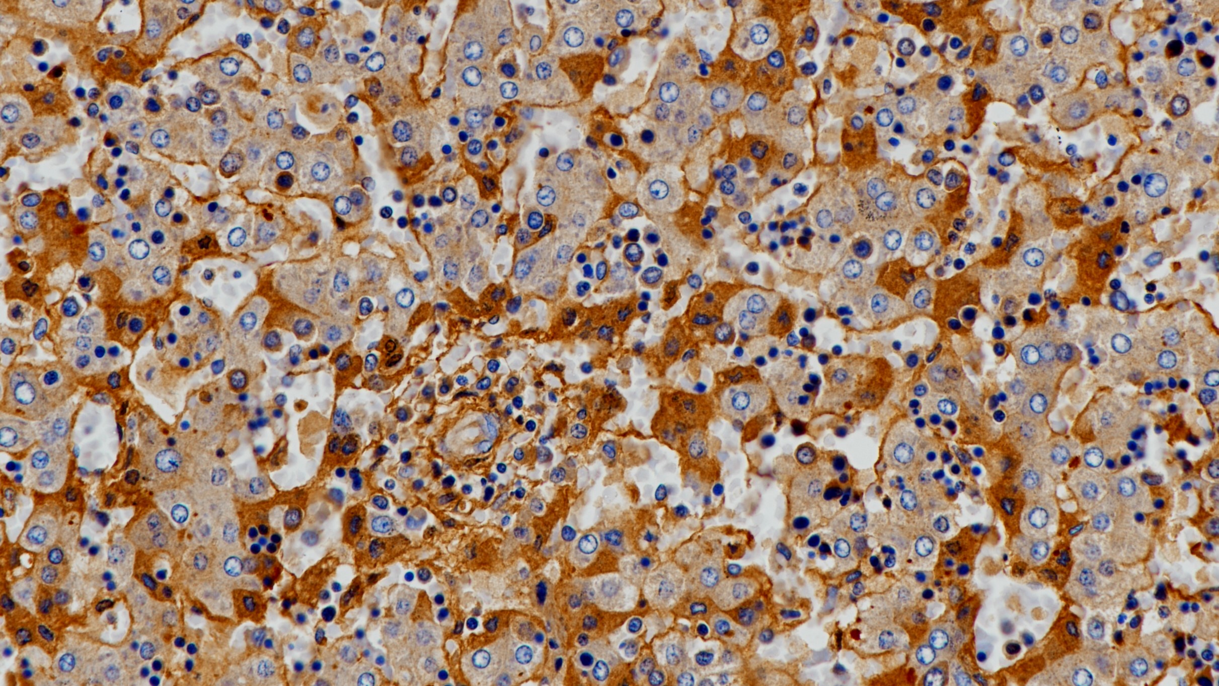 胚肝AFP(poly)染色