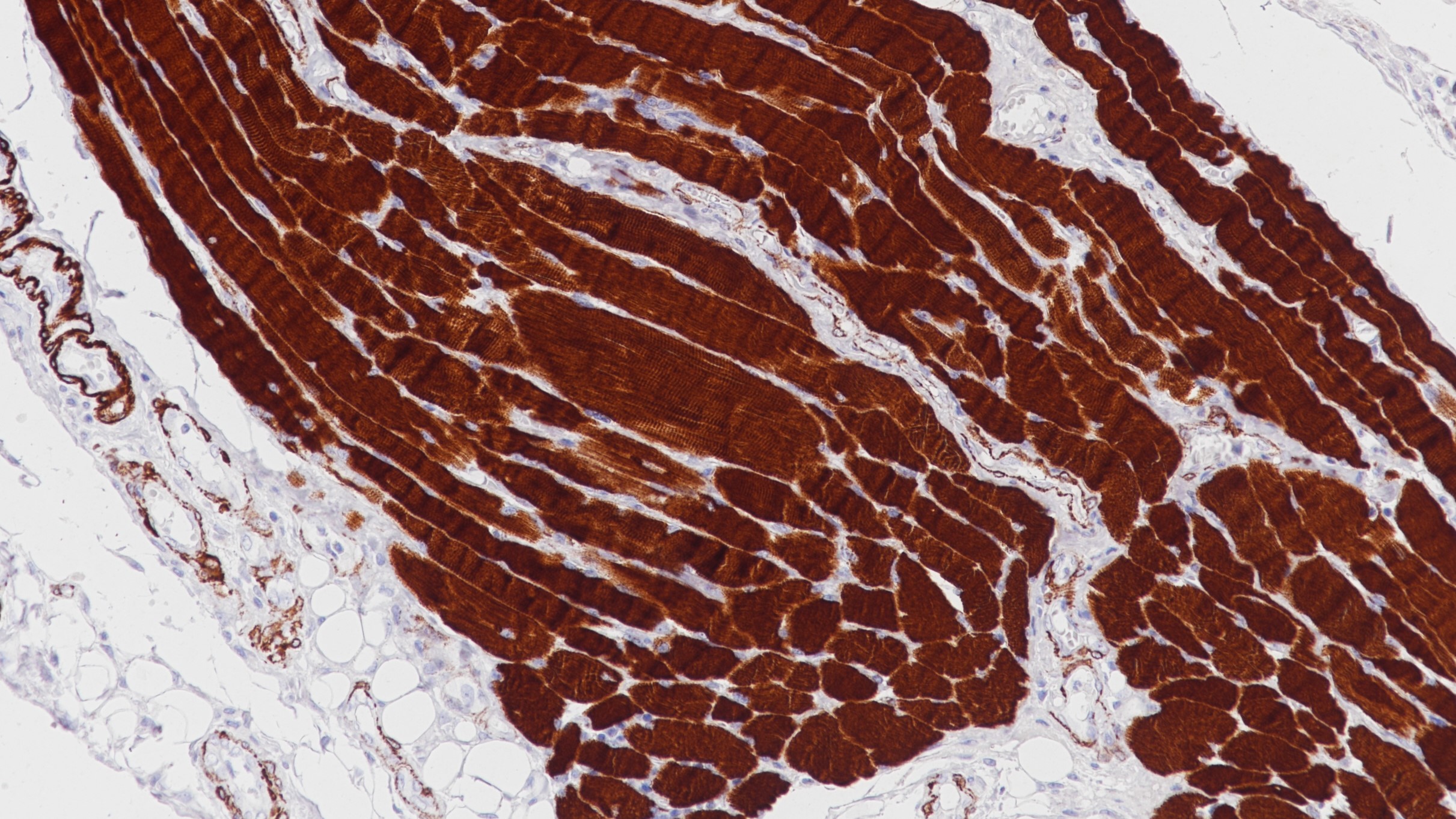 骨骼肌MSA(SC28)染色