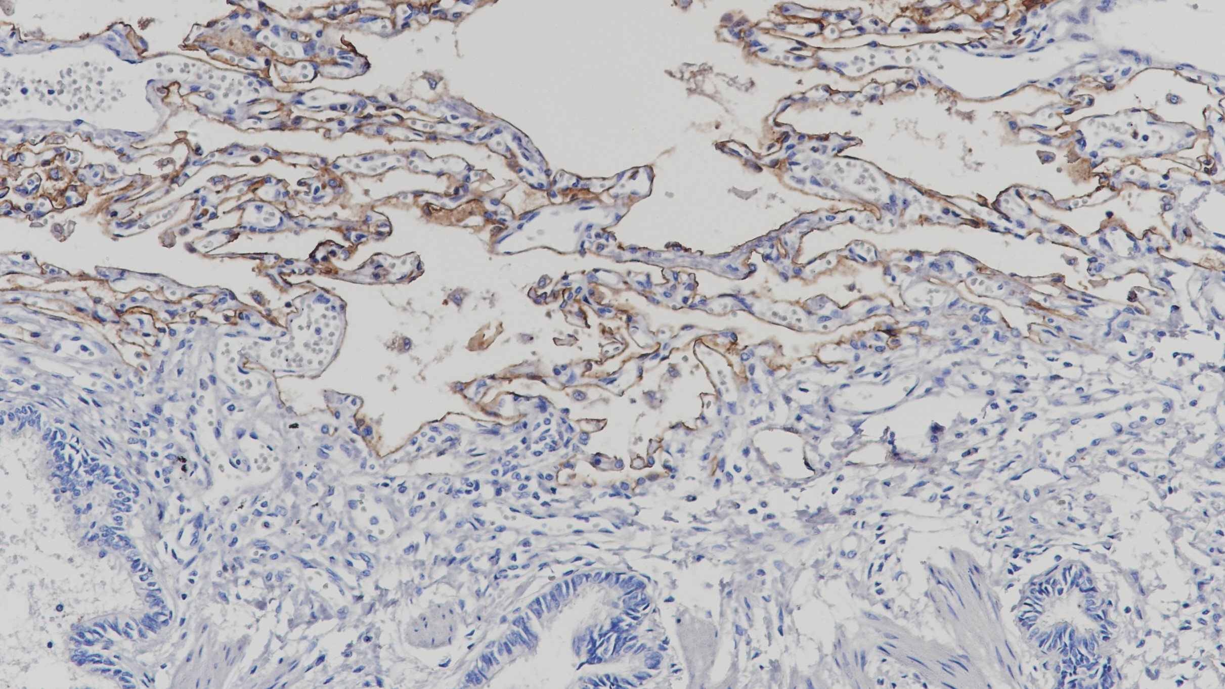 肺Podoplanin(BP6110)染色