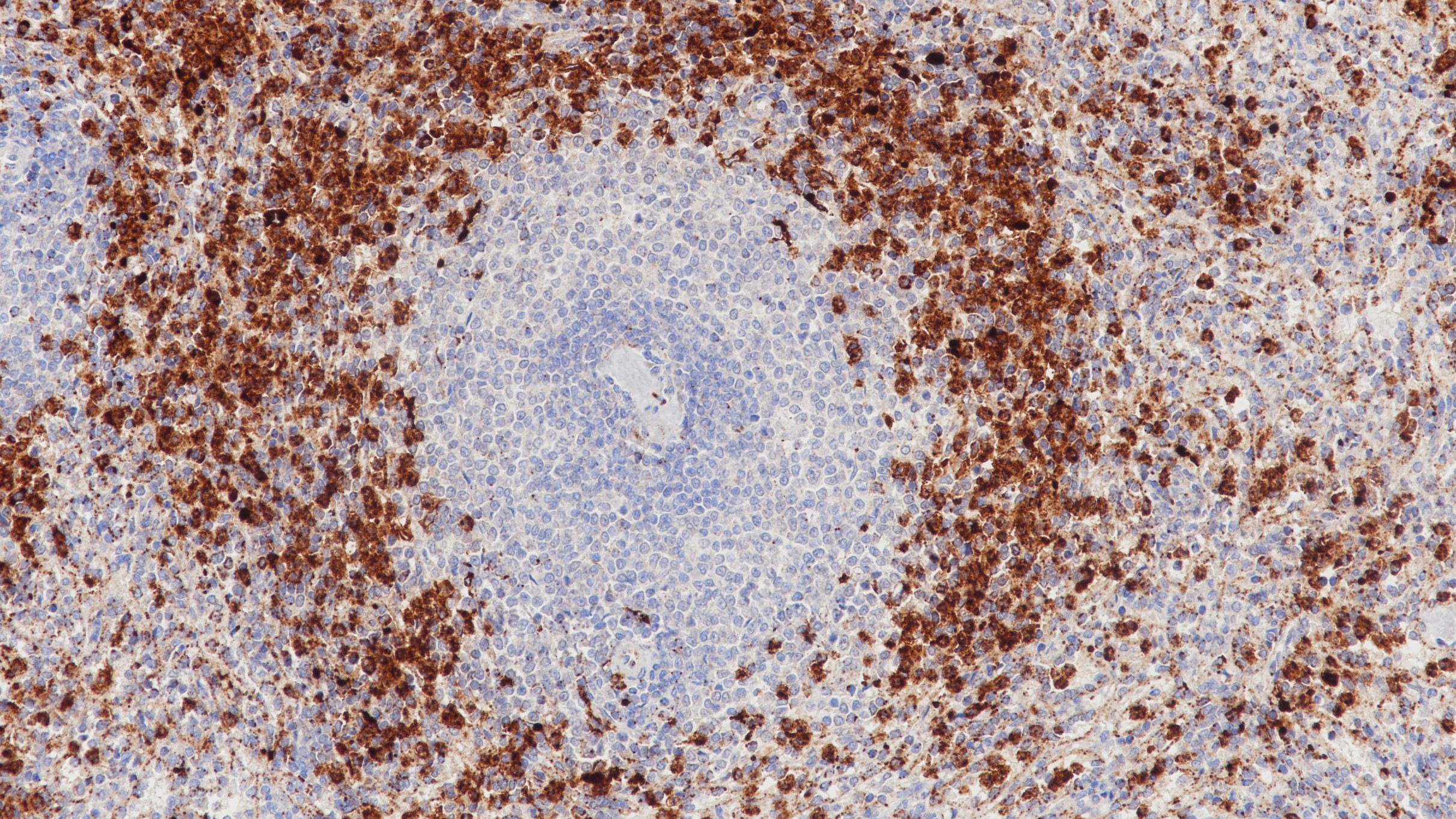 脾MPO(BP6104)染色