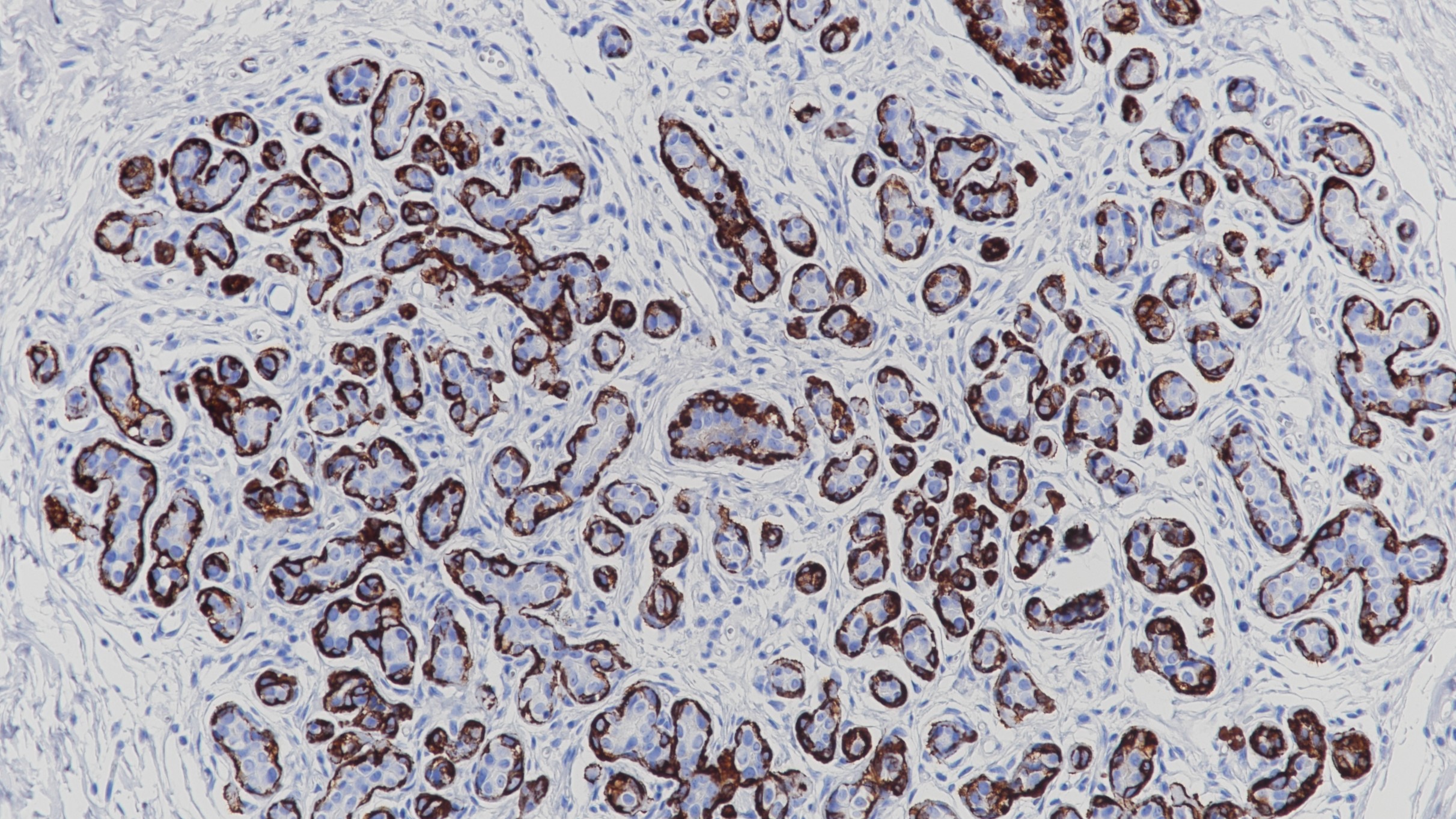 乳腺Myosin(Smooth Muscle)(BP6091)染色