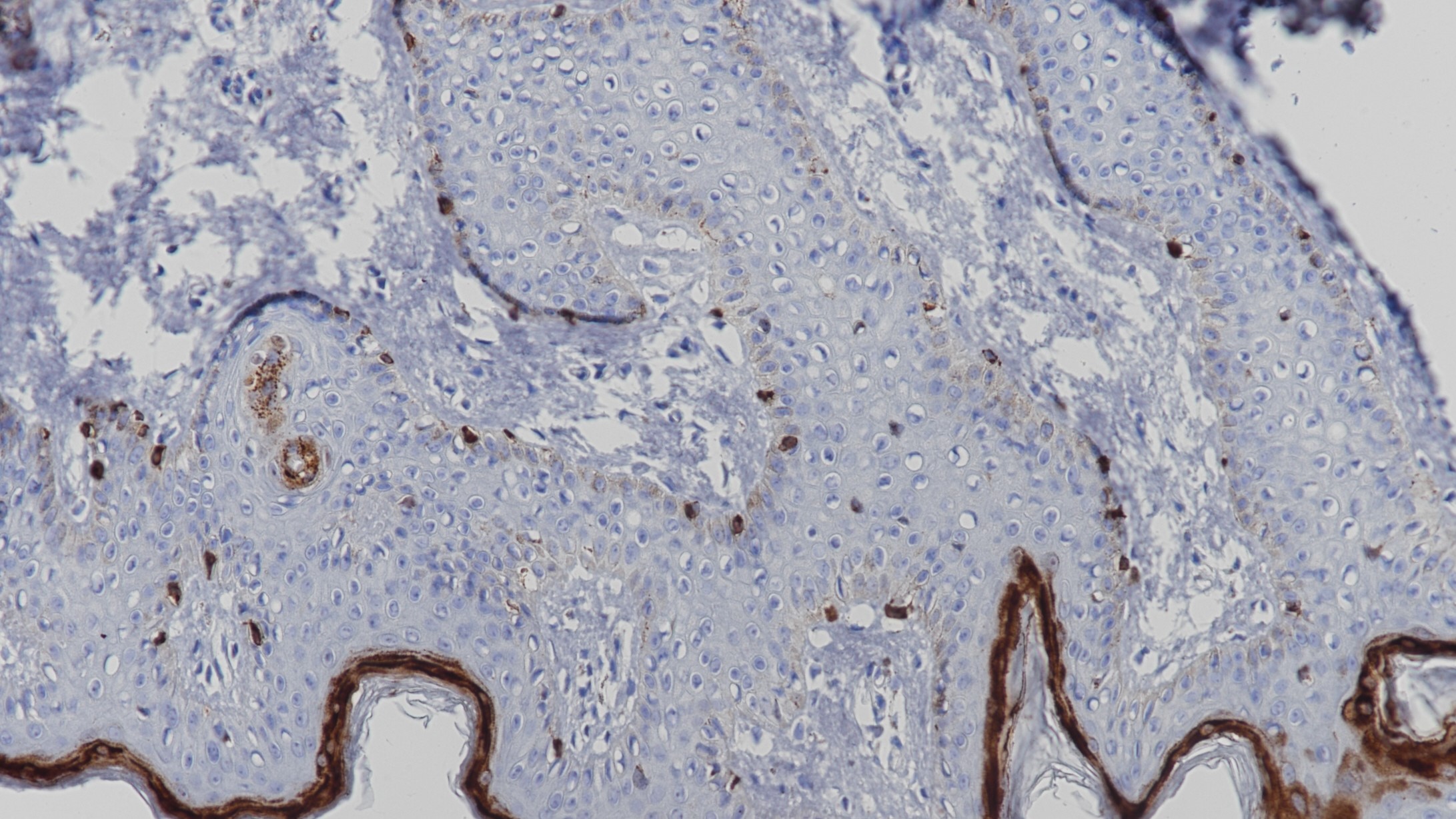 皮肤Melan-A(BP6086)染色