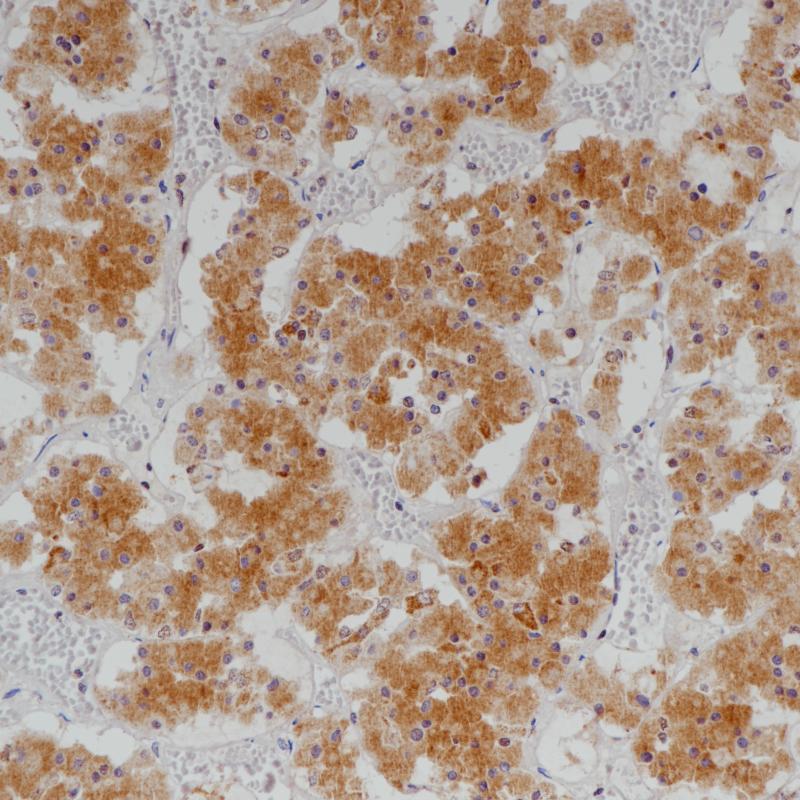 垂体前叶Growth Hormone(BPM6190)染色