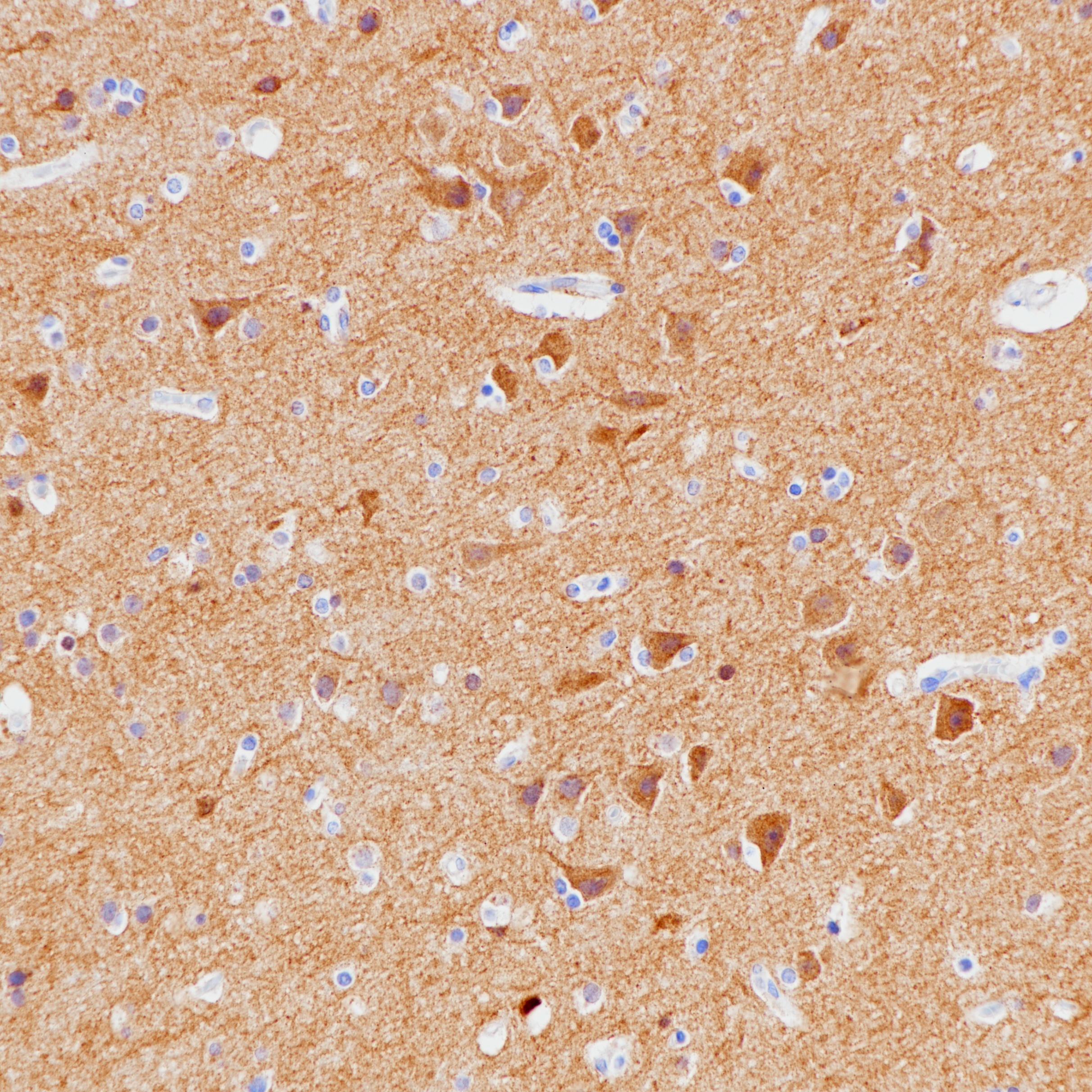 脑TRK（BP6210）染色