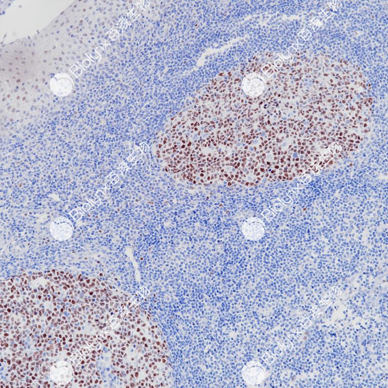 扁桃体Bcl-6（BP6261）染色