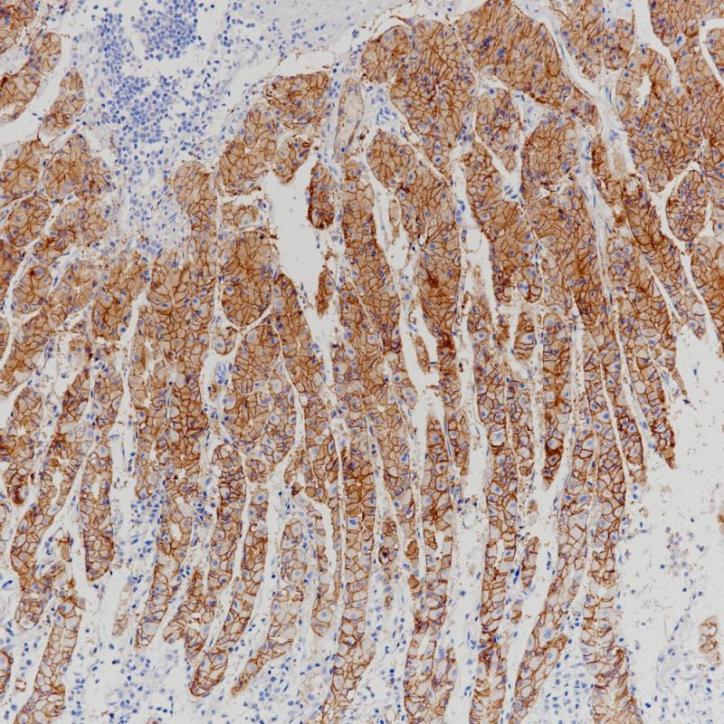 胃Claudin 18.2（BP6249）染色