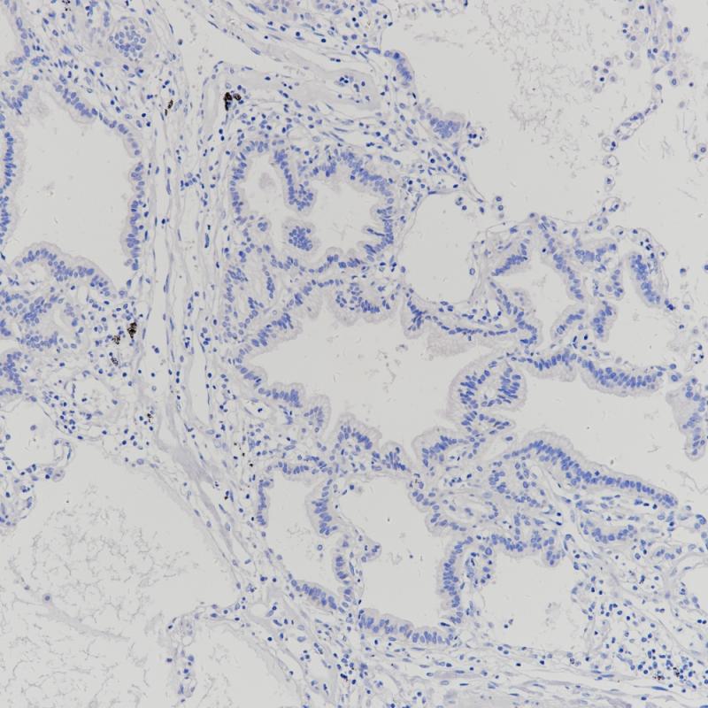 肺Claudin 18.2（BP6249）染色
