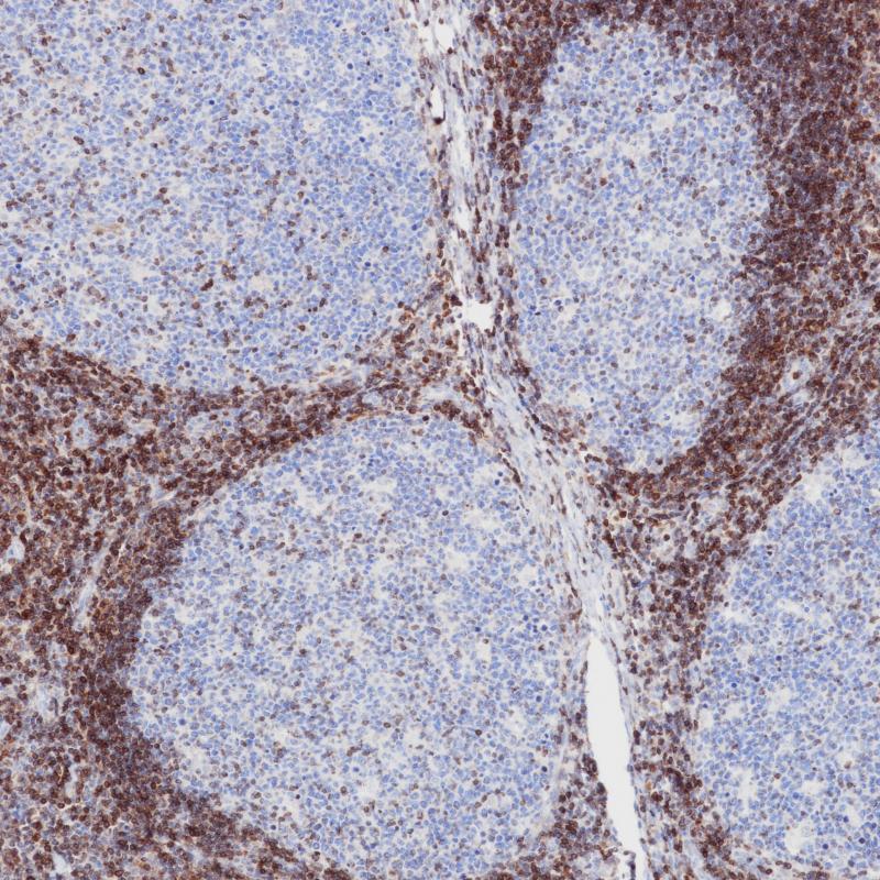 扁桃体Bcl-2(8C8)染色