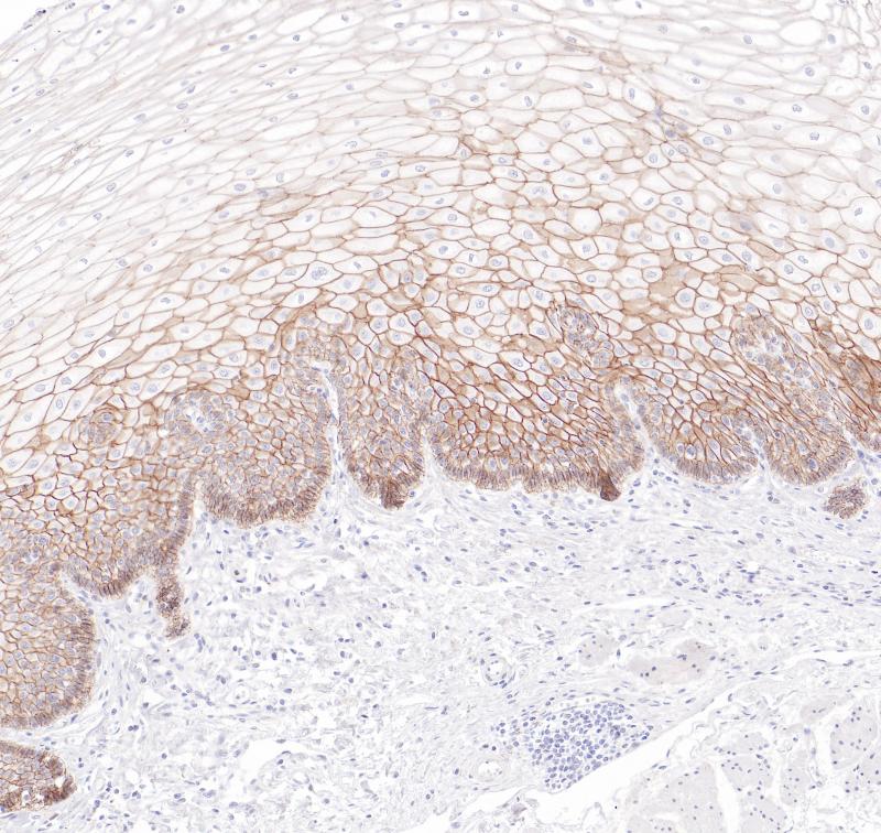 食管pan-Cadherin（BP6296）染色