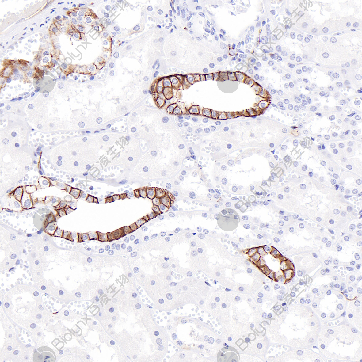 肾L1CAM(BP6257)染色