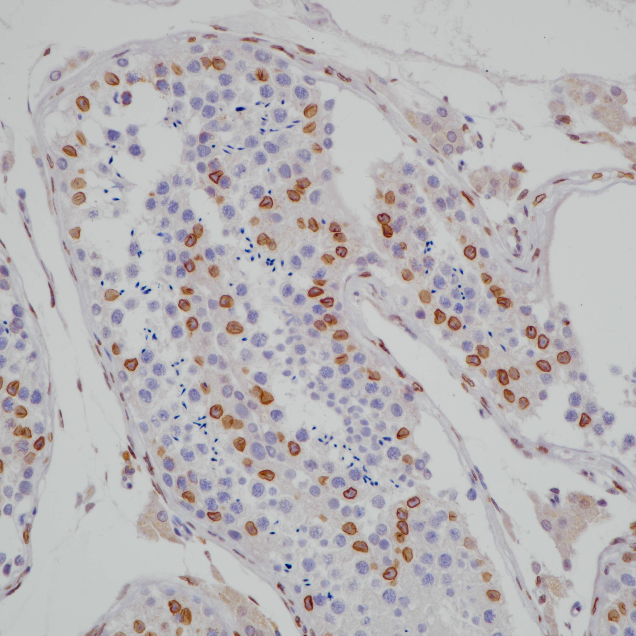 睾丸 CDK4(BP6230)染色