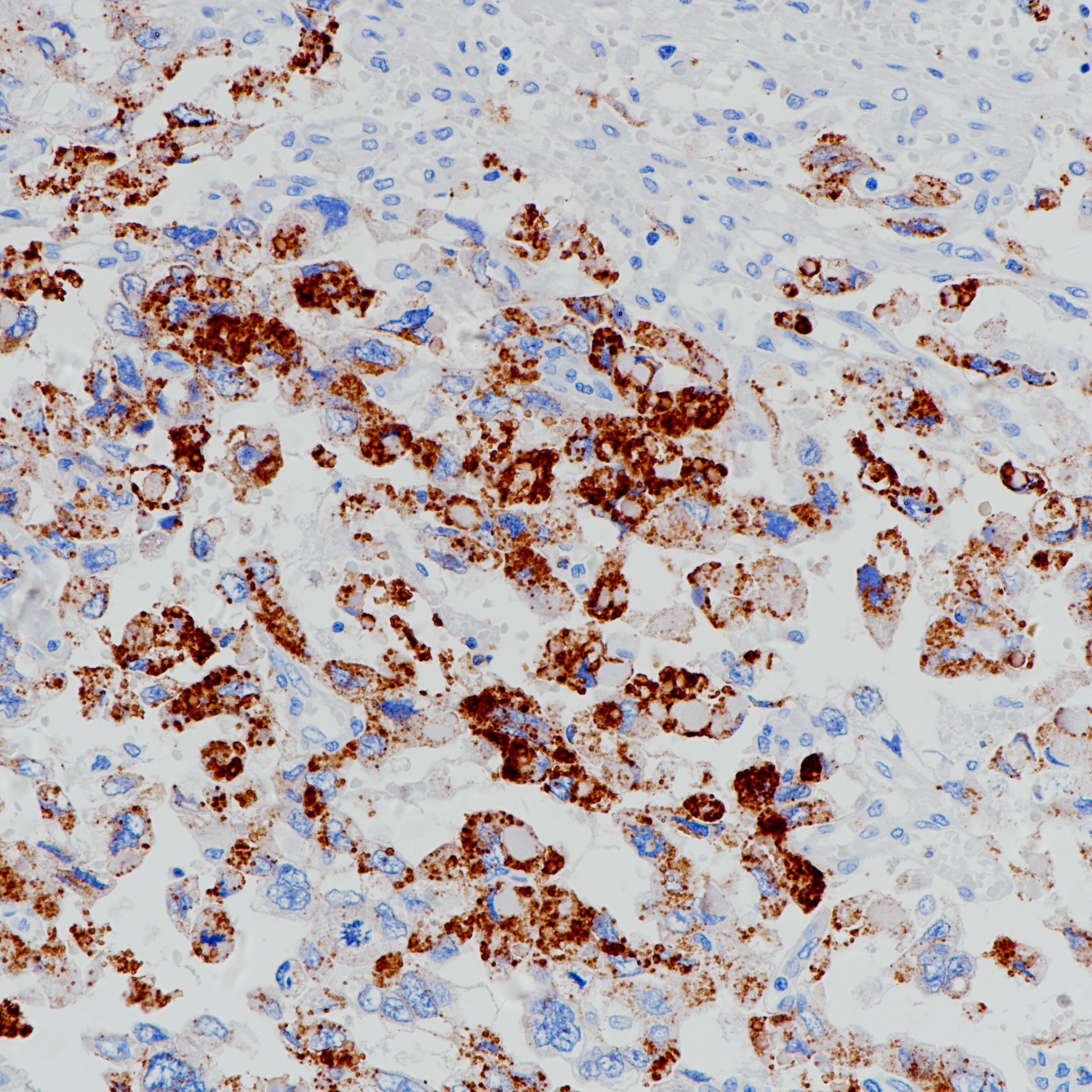  胚胎性癌 GLP3（BP6228）染色