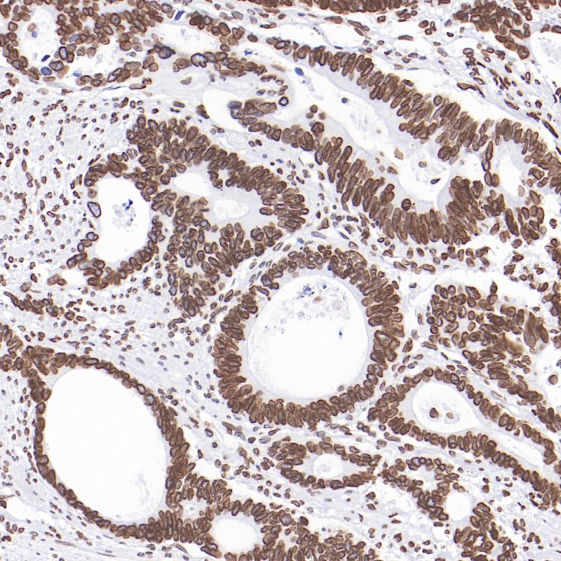 结肠癌Lamin B1（BP6316）染色