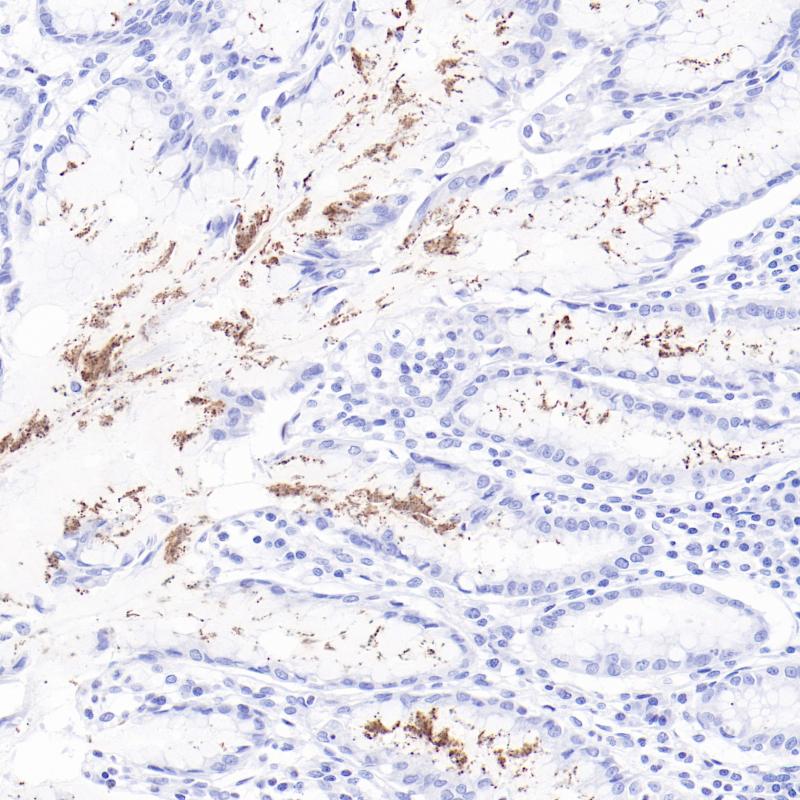 胃HP（BP6321）染色